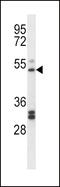 Prostaglandin I2 Receptor antibody, 57-726, ProSci, Western Blot image 