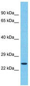 Transmembrane P24 Trafficking Protein 5 antibody, TA330775, Origene, Western Blot image 