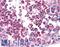 MAGE Family Member A3 antibody, LS-B4662, Lifespan Biosciences, Immunohistochemistry paraffin image 