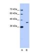 GIPC PDZ Domain Containing Family Member 1 antibody, NBP1-57426, Novus Biologicals, Western Blot image 