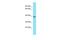 Transmembrane Protein 121 antibody, A17341, Boster Biological Technology, Western Blot image 