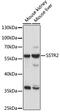 Somatostatin Receptor 2 antibody, 15-879, ProSci, Western Blot image 