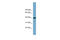 SAM and SH3 domain-containing protein 3 antibody, ARP57305_P050, Aviva Systems Biology, Western Blot image 