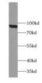 TBC1 Domain Family Member 5 antibody, FNab08515, FineTest, Western Blot image 