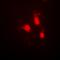 Calcium/Calmodulin Dependent Protein Kinase IV antibody, orb393230, Biorbyt, Immunofluorescence image 