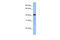 GDP-Mannose Pyrophosphorylase A antibody, 26-386, ProSci, Western Blot image 