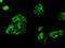 Fermitin Family Member 2 antibody, MA5-24940, Invitrogen Antibodies, Immunocytochemistry image 