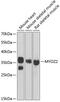 Myozenin 2 antibody, GTX32734, GeneTex, Western Blot image 
