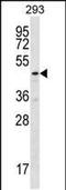 Tubulin Folding Cofactor E Like antibody, PA5-48374, Invitrogen Antibodies, Western Blot image 