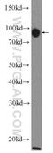 Wolframin ER Transmembrane Glycoprotein antibody, 11558-1-AP, Proteintech Group, Western Blot image 