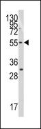 TRF antibody, PA5-12344, Invitrogen Antibodies, Western Blot image 