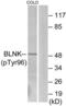 BLNK antibody, LS-C198688, Lifespan Biosciences, Western Blot image 