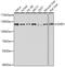 Staphylococcal Nuclease And Tudor Domain Containing 1 antibody, GTX33508, GeneTex, Western Blot image 