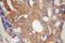 HUS1 Checkpoint Clamp Component antibody, 11223-1-AP, Proteintech Group, Immunohistochemistry frozen image 