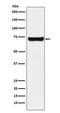 Sestrin 1 antibody, M05559, Boster Biological Technology, Western Blot image 