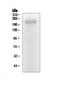 ATP Binding Cassette Subfamily C Member 2 antibody, A00974-1, Boster Biological Technology, Western Blot image 