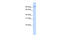 Pyridoxal Dependent Decarboxylase Domain Containing 1 antibody, 26-972, ProSci, Enzyme Linked Immunosorbent Assay image 