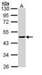 Protein Phosphatase, Mg2+/Mn2+ Dependent 1A antibody, PA5-29041, Invitrogen Antibodies, Western Blot image 