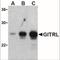 TNF Superfamily Member 18 antibody, NBP1-77240, Novus Biologicals, Western Blot image 