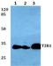 Taste 2 Receptor Member 1 antibody, A08714-1, Boster Biological Technology, Western Blot image 