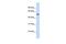 GTP Binding Protein 10 antibody, GTX46948, GeneTex, Western Blot image 