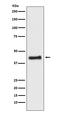Nuclear Receptor Subfamily 2 Group F Member 1 antibody, M03833, Boster Biological Technology, Western Blot image 