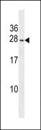 Phosphatidylinositol Glycan Anchor Biosynthesis Class P antibody, PA5-48800, Invitrogen Antibodies, Western Blot image 