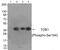 Transducer Of ERBB2, 1 antibody, PA5-37780, Invitrogen Antibodies, Western Blot image 