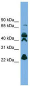 Ribulose-phosphate 3-epimerase antibody, TA345128, Origene, Western Blot image 