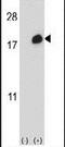 ISG15 Ubiquitin Like Modifier antibody, PA5-11269, Invitrogen Antibodies, Western Blot image 