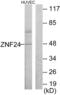 Zinc Finger Protein 24 antibody, abx013404, Abbexa, Western Blot image 