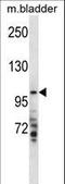 Transmembrane Serine Protease 7 antibody, LS-C162045, Lifespan Biosciences, Western Blot image 