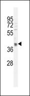 OTU Deubiquitinase 3 antibody, LS-C163292, Lifespan Biosciences, Western Blot image 