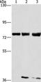 Gamma-Glutamyl Carboxylase antibody, PA5-50417, Invitrogen Antibodies, Western Blot image 