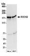 Rho Associated Coiled-Coil Containing Protein Kinase 2 antibody, NB100-593, Novus Biologicals, Western Blot image 