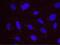 UPF1 antibody, NB100-370, Novus Biologicals, Proximity Ligation Assay image 