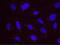 Rent1 antibody, NB100-370, Novus Biologicals, Proximity Ligation Assay image 