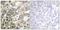 Mucin 1, Cell Surface Associated antibody, GTX55325, GeneTex, Immunohistochemistry paraffin image 