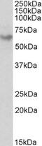 Integrin Subunit Beta 5 antibody, 45-777, ProSci, Enzyme Linked Immunosorbent Assay image 