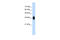 Makorin Ring Finger Protein 1 antibody, 29-841, ProSci, Western Blot image 