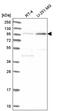 Adaptor Related Protein Complex 2 Subunit Alpha 2 antibody, PA5-65347, Invitrogen Antibodies, Western Blot image 