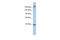 Eukaryotic Translation Initiation Factor 4 Gamma 1 antibody, A01351-1, Boster Biological Technology, Western Blot image 