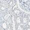 Apoptosis Associated Tyrosine Kinase antibody, PA5-52646, Invitrogen Antibodies, Immunohistochemistry frozen image 