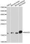 N(Alpha)-Acetyltransferase 20, NatB Catalytic Subunit antibody, STJ29185, St John