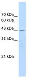 Cholinergic Receptor Nicotinic Beta 2 Subunit antibody, TA338497, Origene, Western Blot image 