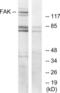 Protein Tyrosine Kinase 2 antibody, LS-C118117, Lifespan Biosciences, Western Blot image 
