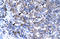 Transcription Factor AP-2 Alpha antibody, orb324371, Biorbyt, Immunohistochemistry paraffin image 