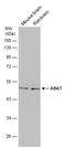 4-Aminobutyrate Aminotransferase antibody, GTX133340, GeneTex, Western Blot image 