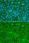 Serpin Family A Member 3 antibody, LS-C331211, Lifespan Biosciences, Immunofluorescence image 
