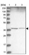 WD Repeat Domain 92 antibody, NBP1-92595, Novus Biologicals, Western Blot image 